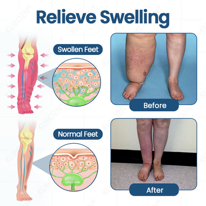 KUBOZN® Official Store|❄️ Ice-Cool Multi-Ball Roller Serum for Lymphatic Support & Swelling Relief